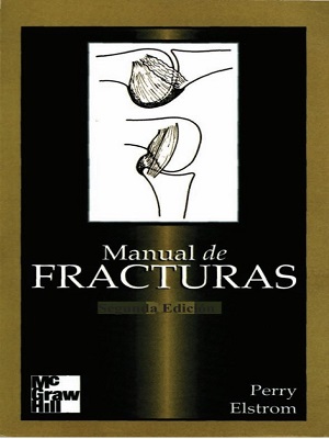 Manual de fracturas - Perry_Elstrom - Segunda Edicion